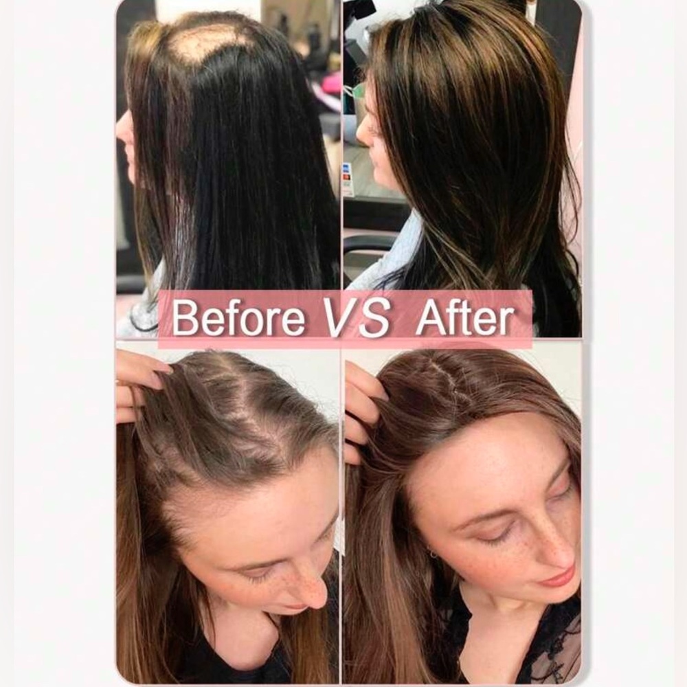 Natural Dark Brown Women’s Clip-In/Topper Hairpiece - Sleek Layered Style - Picture 2 of 14